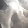 X-ray of healthy human hip